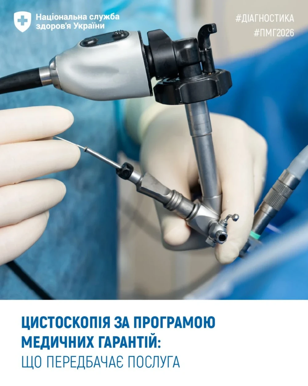 цист